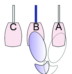 brake pedal